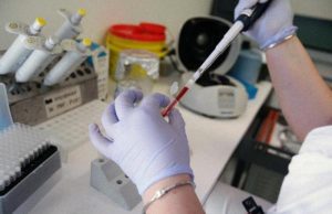 Savona, pensionata 79enne ricoverata in Rianimazione per meningite | Aggiornamento