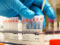 Da Baltimora un nuovo test per individuare gli otto tumori più comuni