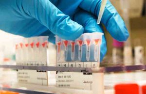 Da Baltimora un nuovo test per individuare gli otto tumori più comuni