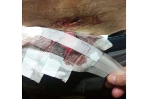 Accoltellamento Antifa piazza Alimonda e aggressione Boccadasse: chiuse indagini su CPI