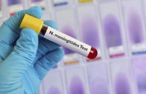 Pensionato di Pieve Ligure ricoverato per meningite al San Martino