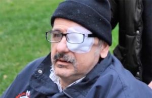 Perse un occhio, per razzo segnalazione: maxi risarcimento