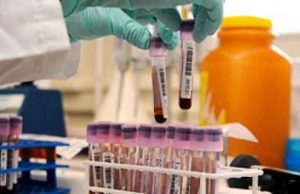 Coronavirus | Accesso attività centri prelievi ASL1