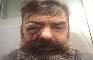 Francia europeista e colonialista: polizia spara, leader gilet gialli perde occhio | Video