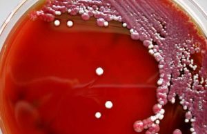 Il batterio sul sapone ospedaliero contaminato