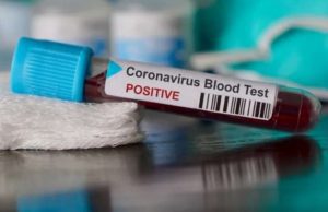 Focolaio Savona: 56 positivi (tre in più di ieri). Solo 5 ospedalizzati e in buone condizioni