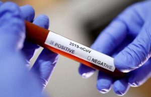 Liguria, zero morti e 79 guariti. Malati -20 e ospedalizzati -5. Nuovi casi 59