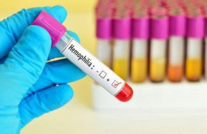 Fondazione Telethon 3,6 milioni di euro per la ricerca