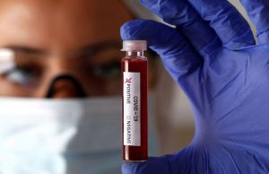 Liguria, un morto e 79 guariti. malati -15 e ospedalizzati +3. Nuovi casi 65