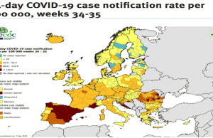 Prof. Bassetti: virus meno aggressivo, non è come a marzo. Conferma anche da Usa