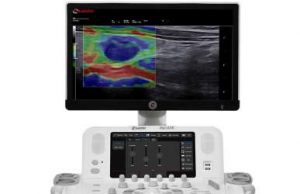 Dopo UE e USA cresce ancora la diffusione di Esaote