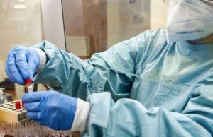 UECOOP, allarme varianti, a rischio gli over80