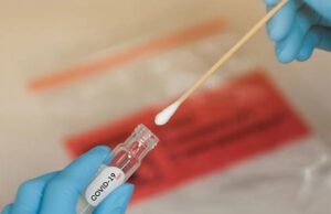 Tamponi fake in farmacia, sempre negativi al coronavirus. Bassetti: scandaloso Alisa sospende piano monitoraggio tamponi salivari nelle scuole