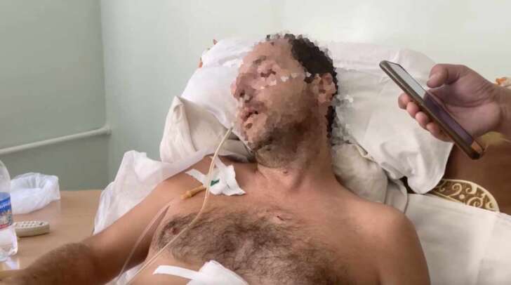 Giornalista italiano al fronte rimane ferito e viene salvato dai russi