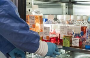 La malattia rara ha consumato Michele La malattia rara ha consumato Michele