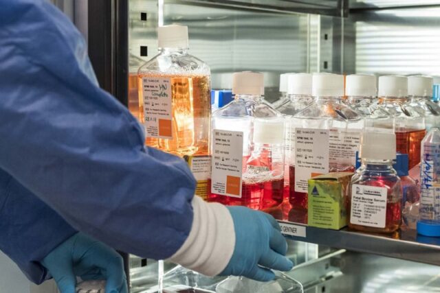 La malattia rara ha consumato Michele La malattia rara ha consumato Michele