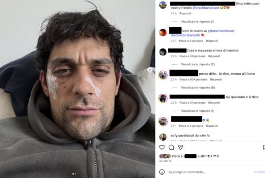 Bresh ferito al volto ironizza: Dobermann 1 – Andrea 0 Bresh ferito al volto ironizza: Dobermann 1 - Andrea 0